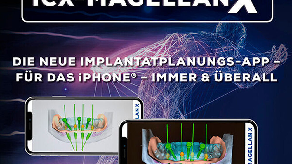 Mit MAGELLAN X bietet medentis eine digitale Implantatplanungs-App für das iPhone an.