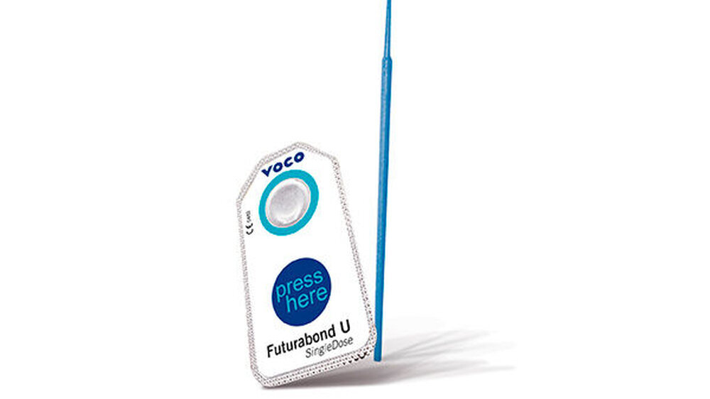 Für ein optimales Ergebnis ist neben dem Komposit das Bonding ebenso entscheidend. Mit Futurabond U in der SingleDose bietet VOCO ein dualhärtendes Universaladhäsiv in einer Einmalapplikationsform an.