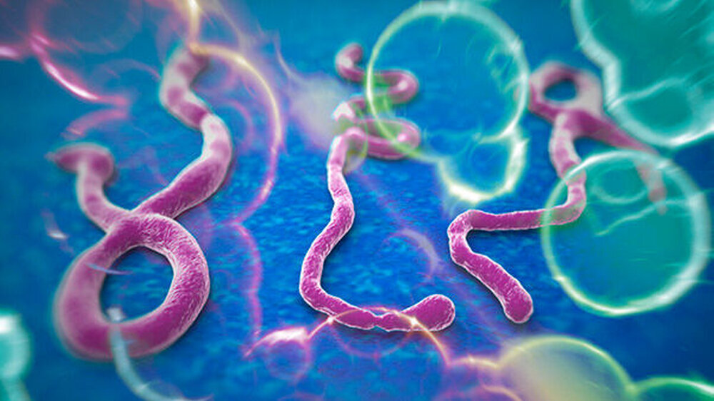 Das Ebola-Virus unter dem Mikroskop.