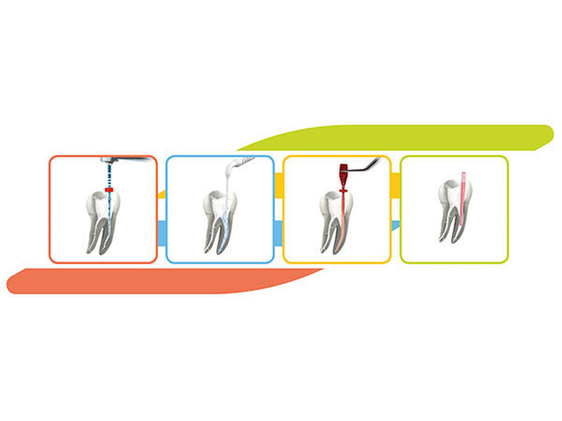 EndoSystem inklusive Gelassenheit
