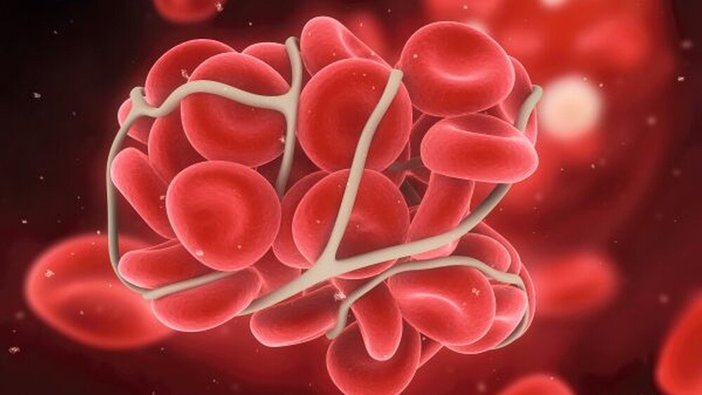 In Sachen Blutgerinnung und Gerinnungshemmer gibt es Neuerungen. |