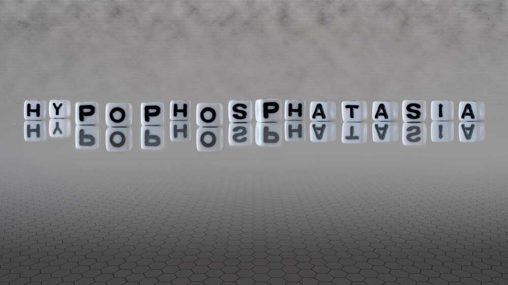 hypophosphatasia word or concept represented by black and white letter cubes on a grey horizon background stretching to infinity