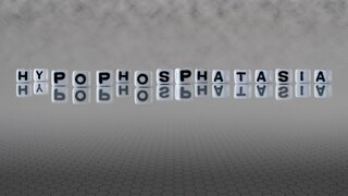 hypophosphatasia word or concept represented by black and white letter cubes on a grey horizon background stretching to infinity