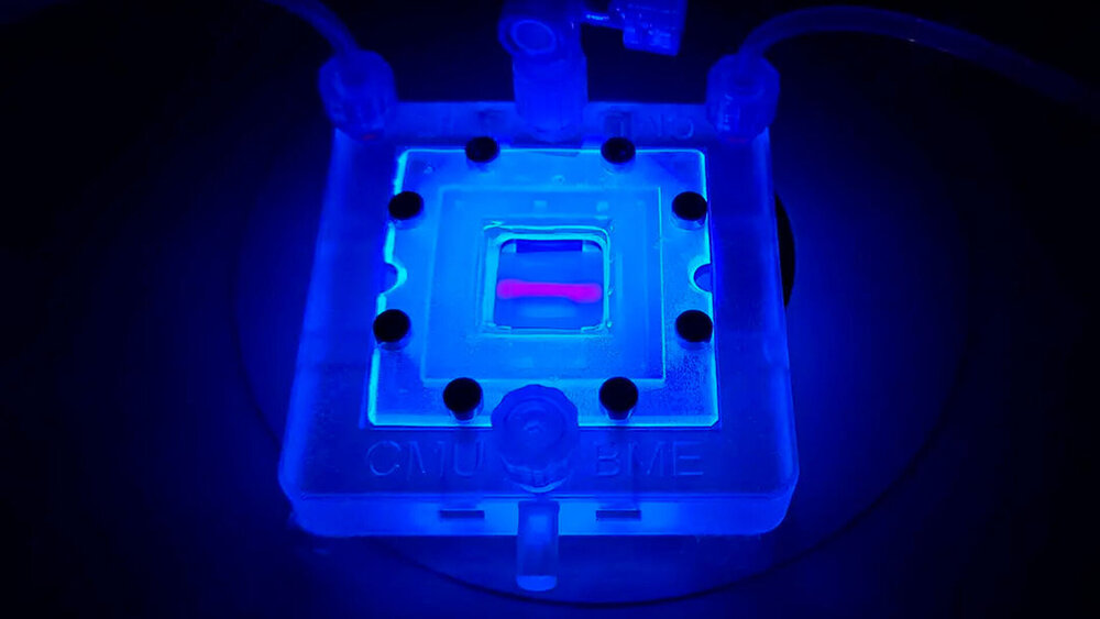 3-D-Druck lebender Zellen: Hilfe für Diabetes-Patienten