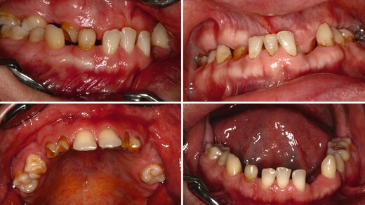 587003-flexible-1900 587003-flexible-1900