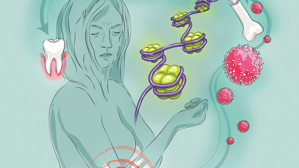 Das Immunsystem erinnert sich und oft ist dies vorteilhaft. Wenn jedoch aufgrund chronischer Entzündungen wie Parodontitis sich die Vorläuferzellen des Immunsystems im Knochenmark verändern und so eine fehlgeleitete Immunreaktion aufrechterhalten wird,