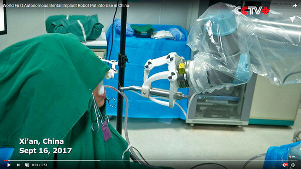 Null Sicht: Das Gesicht der mutigen Testpatientin ist fast vollständig verhüllt, als der Roboterarm seine Arbeit aufnimmt.