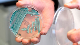 Auf Chromagarplatten wächst der Hefepilz Candida auris in blauen Kolonien.