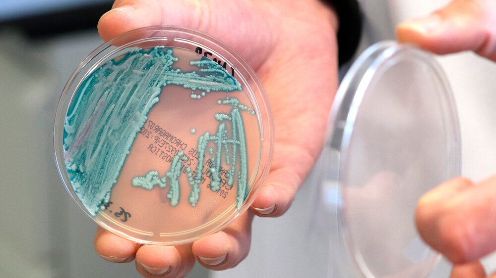 Auf Chromagarplatten wächst der Hefepilz Candida auris in blauen Kolonien.