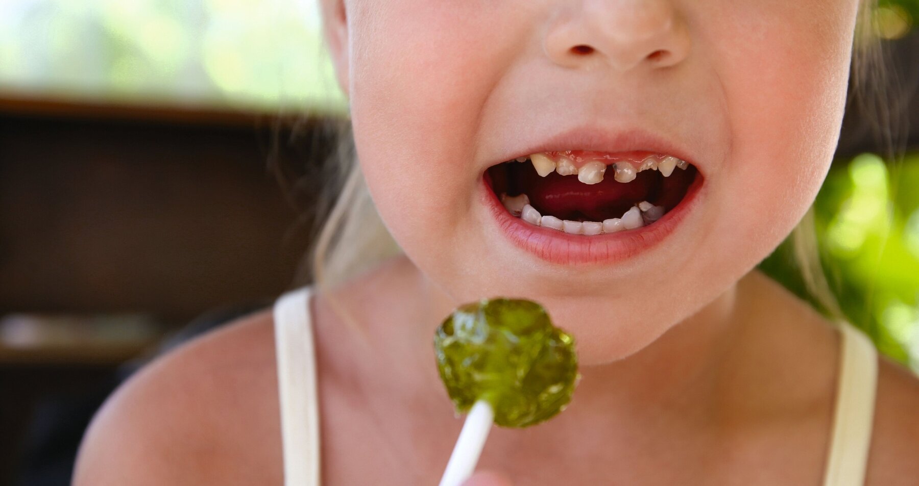 Mädchen mit Lolli und Karies