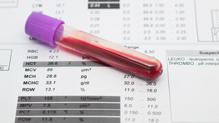 Blutproben im Labor mit Diagnoseschein.