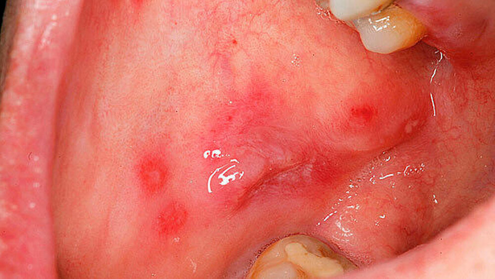 146811-flexible-1900 146811-flexible-1900