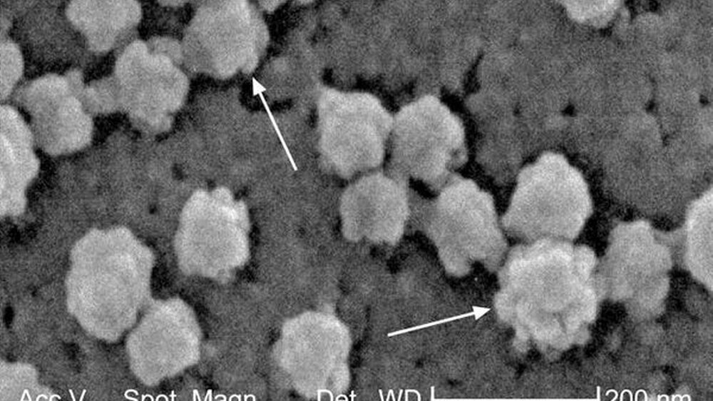 Elektronenmikroskopische Aufnahme von Viruspartikeln des SARS verursachenden Virus SARS-CoV-1.