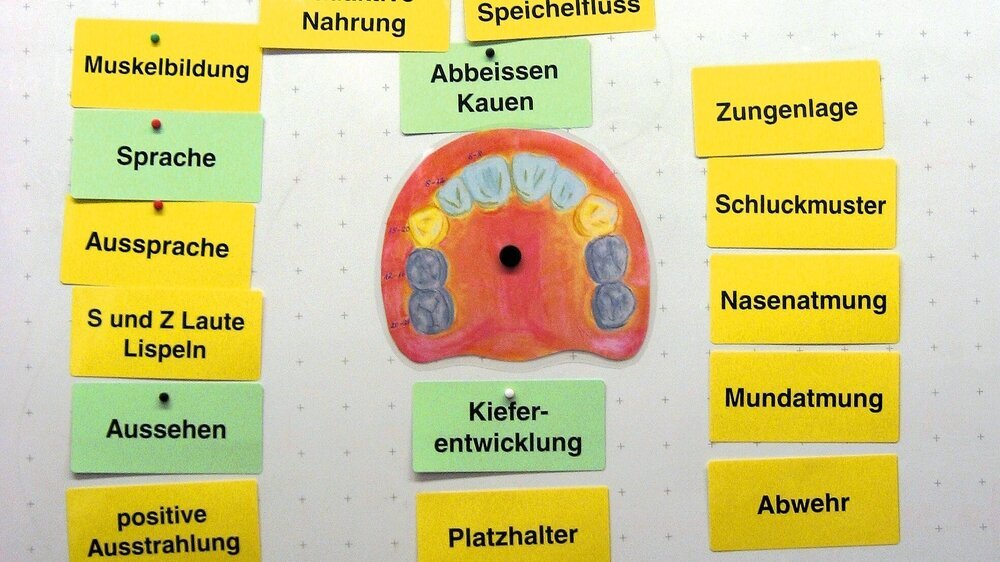 Mithilfe dieser Moderatorenkarten wird im Gespräch mit den angehenden Erzieherinnen eine Übersicht entwickelt. Hinter jeder Moderatorenkarte steckt ein Thema. Deutlich wird, dass ein vollständiges Milchzahngebiss Einfluss auf eine gesunde, ungestörte