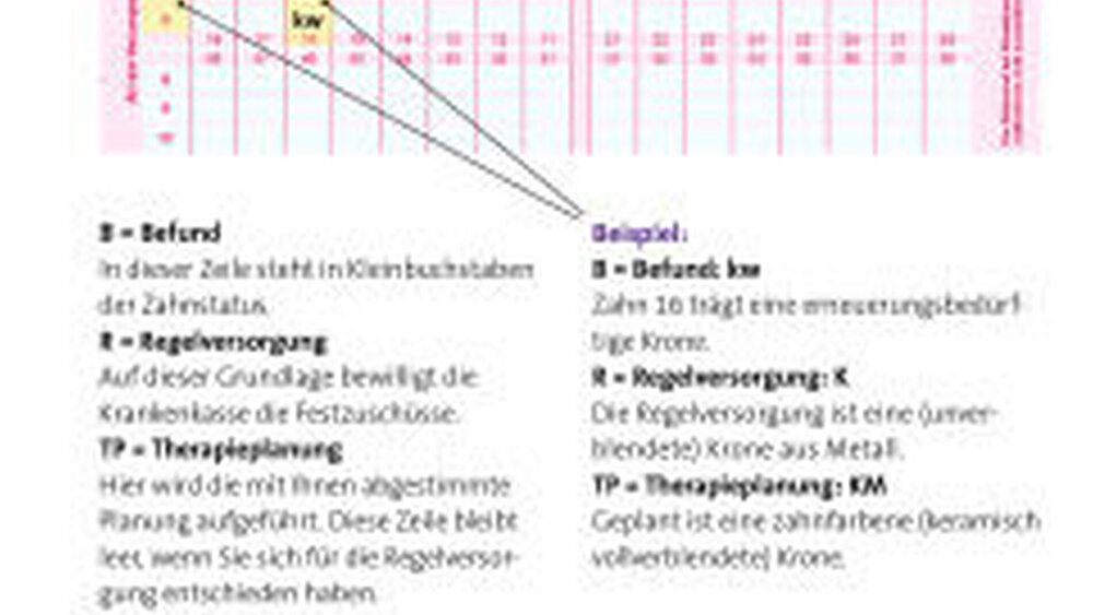 In der KZBV-Broschüre (Deckblatt siehe Abbildung rechts) wird der HKP ausführlich erläutert. |