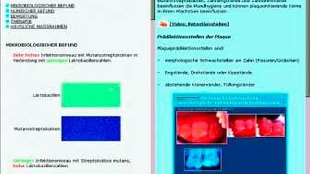 Für den prophylaktisch tätigen Zahnarzt ist „Prophylaxe interaktiv“ ein empfehlenswertes Programm.