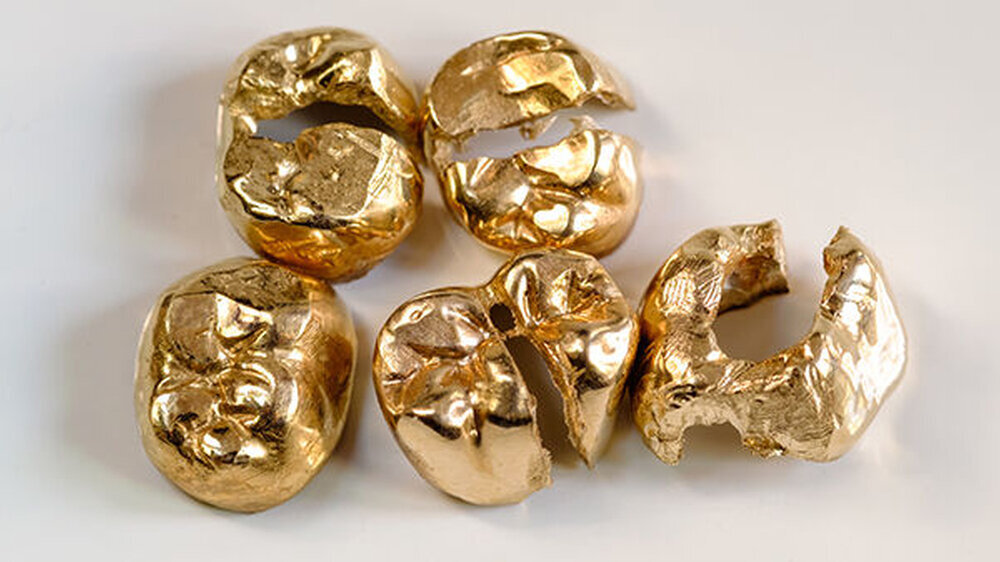 Die Altgoldspende wird abgeholt? Lassen Sie sich nicht von Betrügern abzocken.