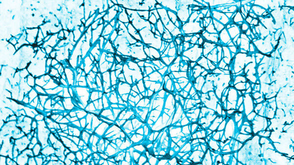 Nanofibröses Peptidnetzwerk mit Poren und Tunneln für die Einlagerung von Schmelzmineralen