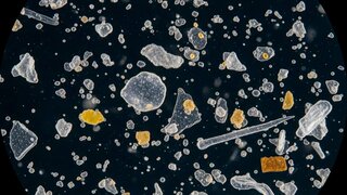 Mikroplastik unter dem Mikroskop, KI-Generiert