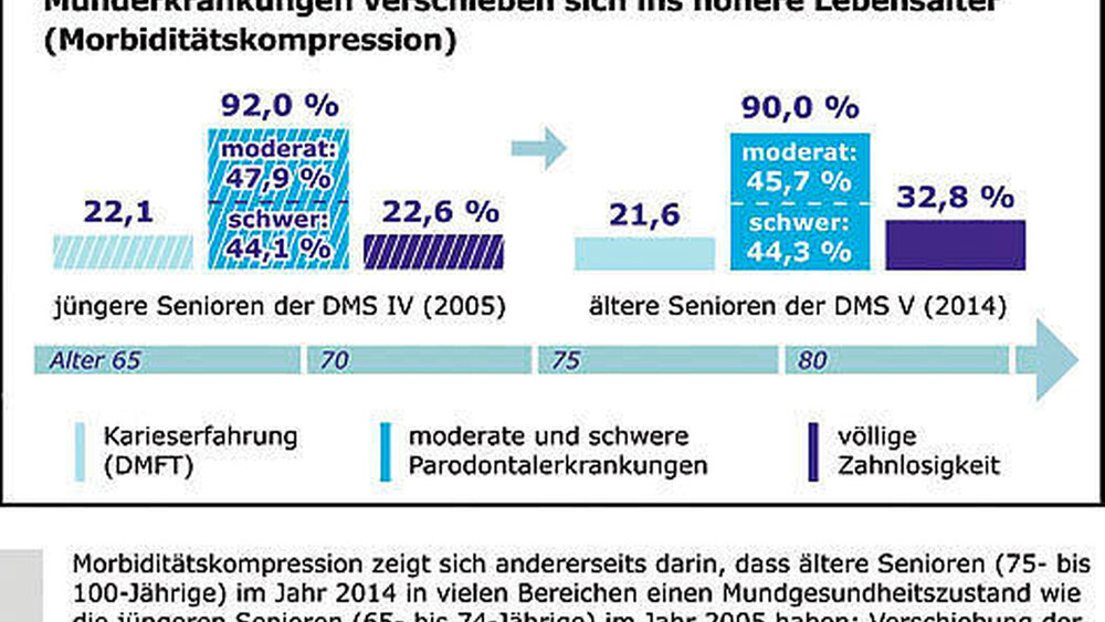 Abbildung 2: Morbiditätskompression zeigt sich einerseits darin, dass ältere Senioren (75- bis 100-Jährige) im Jahr 2014 in vielen Bereichen einen Mundgesundheitszustand wie die jüngeren Senioren (65- bis 74-Jährige) im Jahr 2005 haben: Verschiebung der Krankheitslasten in das höhere Lebensalter. |