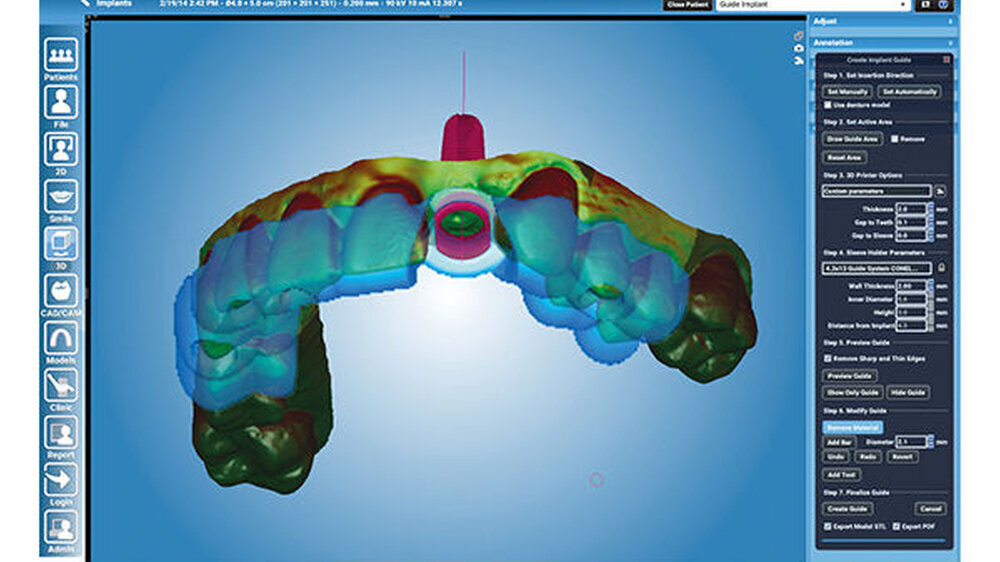 Die vielseitige Planmeca Romexis-Softwareplattform verfügt über zahlreiche Module. Dazu gehören unter anderem ein Implantatplanungs- und ein CAD/CAM-Modul, das Smile Design, sowie ein Clinic Management Software-Modul. So bietet sie Zahnärzten eine au