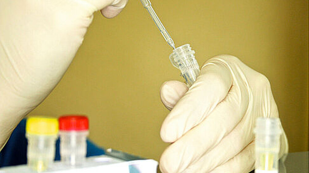 149292-flexible-1900 Abbildung 3: In die Analyseröhrchen mit der Zellsuspension aus Bakterienzellen werden unter anderem die spezifischen Primer zugegeben. |