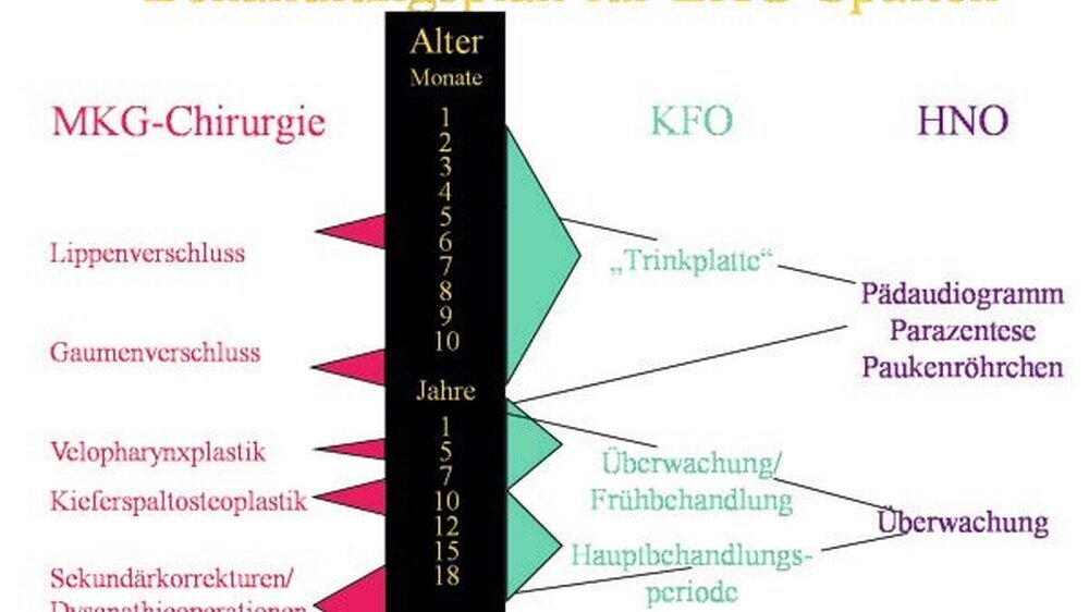Abbildung 1: Schema zum interdisziplinären Behandlungsablauf von Patienten mit Lippen-Kiefer- Gaumen-Spalten am Universitätsklinikum Leipzig