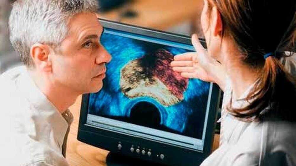 Interdisziplinäre Begutachtung eines Mamma-CA-Verdachts lässt schnell eine sichere\r\nDiagnose zu.