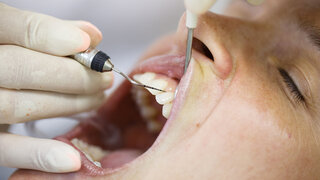 Periodontal probe, held by dental hygienist, measuring pocket depths around tooth, examining progression of periodontal disease. Dental hygiene, periodontal disease and prevention concept.