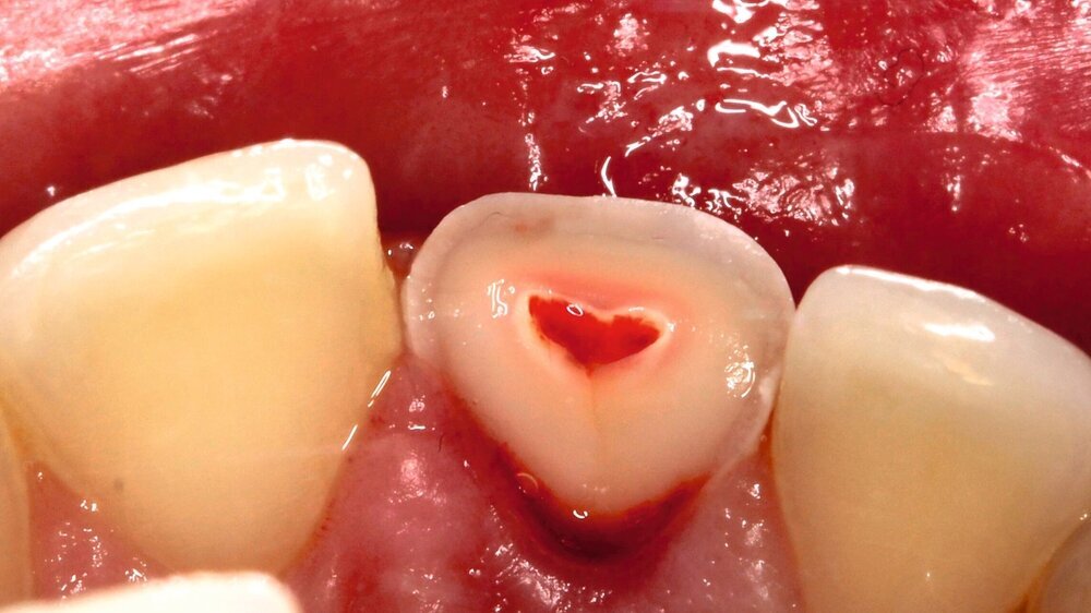 Abbildung 1b: Klinische Darstellung bei Erstbesuch oral