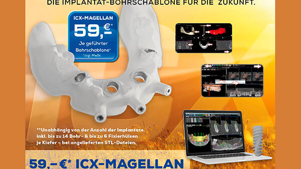 ICX-MAGELLAN ist die bewährte medentis-Software zur digitalen Analyse und Behandlungsplanung. Sie führt den Behandler in wenigen Schritten von der Planung zur Implantation.
