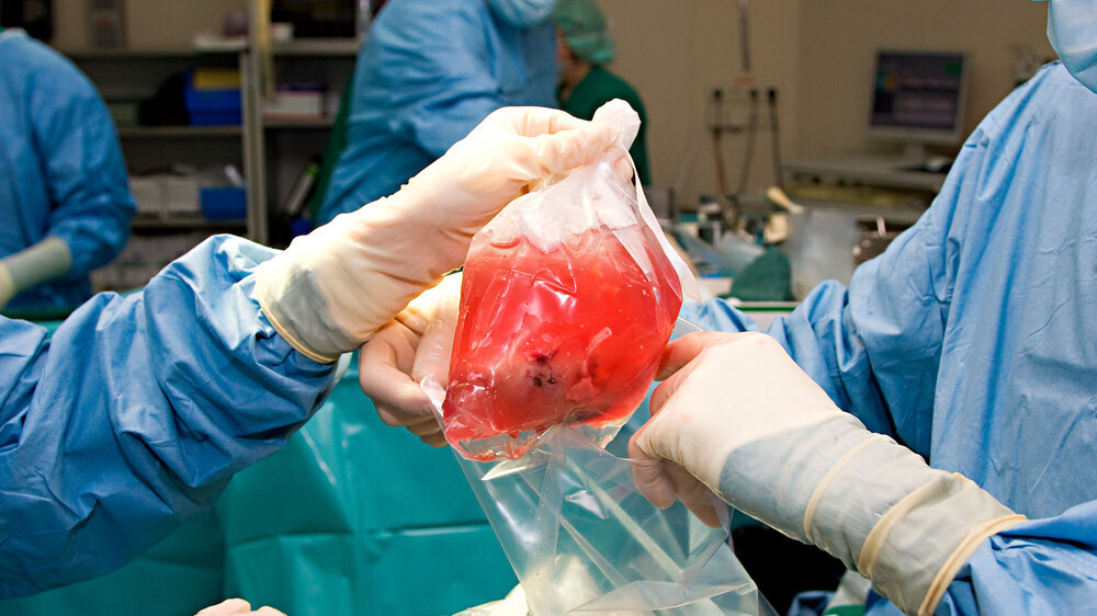 Nierentransplantation