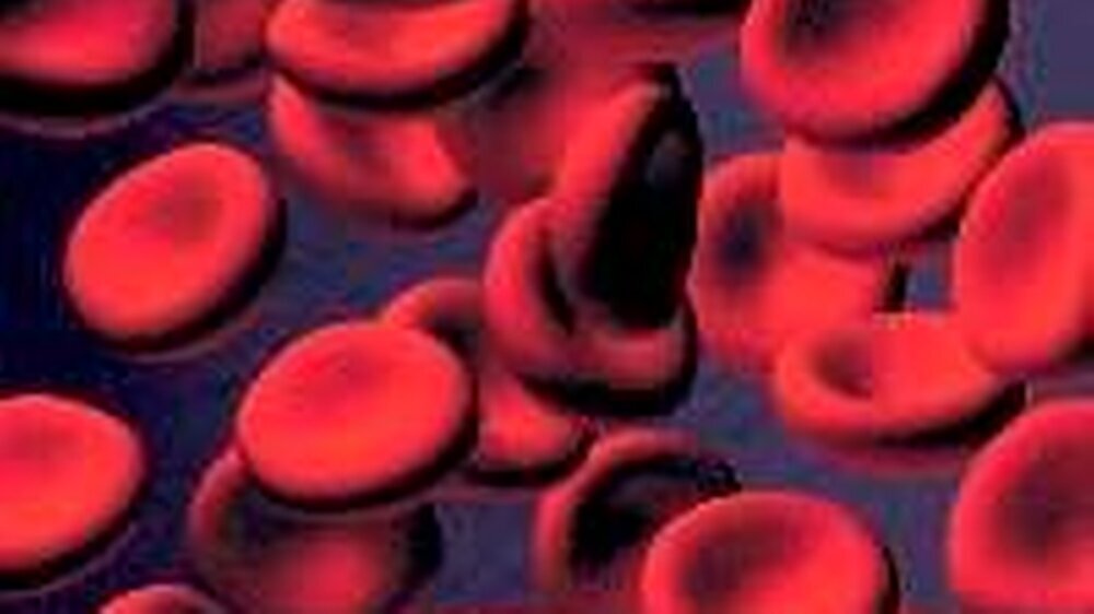 Bei der Anämie werden die typischen suppentellerförmigen, kernlosen Erythrozyten Mangelware.