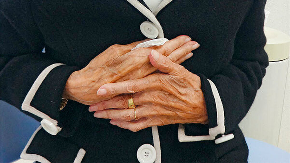 Ein Blick auf die Hände des Patienten hilft, die manuelle Geschicklichkeit einzuschätzen. Ein Blick auf die Hände des Patienten hilft, die manuelle Geschicklichkeit einzuschätzen.