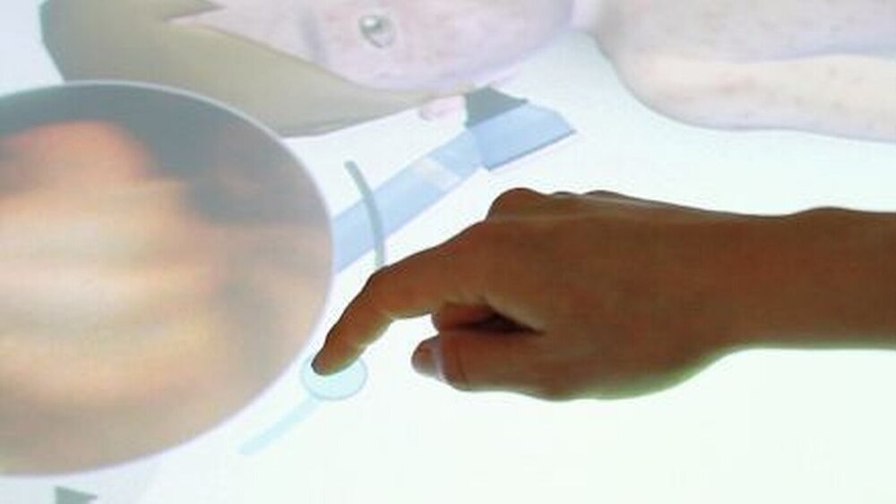 Was sie dort im Realfall zu sehen bekommen würden, wird auf einen Fingertipp hin auf dem Touchscreen als Video abgespielt, Diese je nach simuliertem Krankheitsbild variierenden Clips können beliebig oft abgespielt werden. |