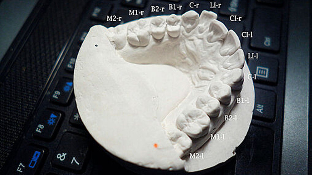 4. „Daraus einen Abguss zu fertigen, war sehr einfach – ich steckte die Abformung einfach verkehrt herum in einen Joghurtbecher und füllte ihn mit flüssigem Permastone auf. Als das Material ausgehärtet war, zog ich den Joghurtbecher ab und glättete mit einem Rasiermesser die Oberflächen. Zwei kleine farbige Punkte auf der Oberfläche des Gussteils dienen als Bezugspunkte für die Skalierung des Laserscans.“ |