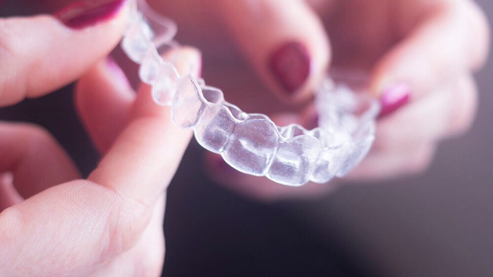 Gewerbliche Anbieter von Aligner-Behandlungen können aktuell das ZHG unterlaufen, weil sie im Unterschied zu Zahnärzten und Kieferorthopäden nicht der Aufsicht der Kammern unterliegen. Für diese Fälle muss es daher laut KZBV und BZÄK gesetzliche Reg