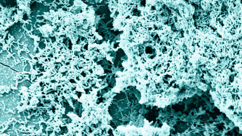 Abbildung 1: Streptococcus mutans Biofilm auf Zahnschmelz | Abbildung 1: Streptococcus mutans Biofilm auf Zahnschmelz |