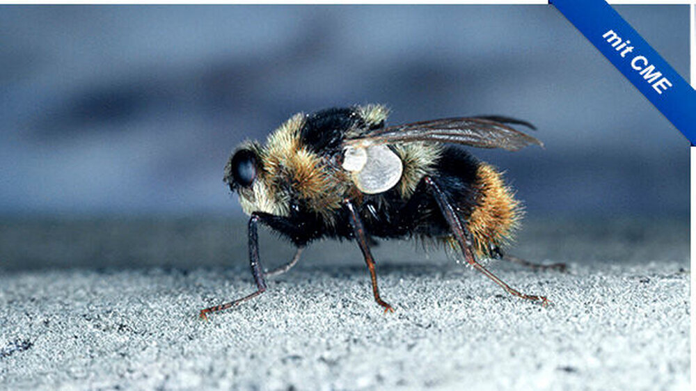 Die furunkuläre Myiasis der Haut (Synonym: kutane Fliegenmadenkrankeit) ist eine seltene tropische Infektion, verursacht durch verschiedene Zweiflügler. Zur Familie der Oestriae (Synonym: Dasselfliegen) gehören viele Fliegenarten, hier die Rinderdassel Die furunkuläre Myiasis der Haut (Synonym: kutane Fliegenmadenkrankeit) ist eine seltene tropische Infektion, verursacht durch verschiedene Zweiflügler. Zur Familie der Oestriae (Synonym: Dasselfliegen) gehören viele Fliegenarten, hier die Rinderdasselfliege (Hypoderma bovis). |