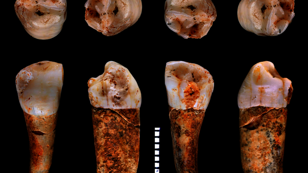 Ein Neandertaler-Prämolarzahn aus dem Höhlensystem von Almonda, Portugal, aus verschiedenen Blickwinkeln betrachtet. Mithilfe von Strontium-Isotopen wurde die Bewegung dieses Individuums während der Jahre der Amelogenese verfolgt. Ein Neandertaler-Prämolarzahn aus dem Höhlensystem von Almonda, Portugal, aus verschiedenen Blickwinkeln betrachtet. Mithilfe von Strontium-Isotopen wurde die Bewegung dieses Individuums während der Jahre der Amelogenese verfolgt.