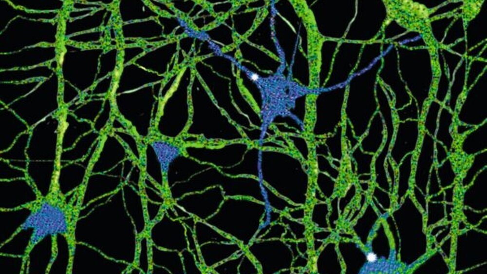 Das Dentriten- und Axionen-Geflecht zwischen einzelnen Neuronen: Dieses Schaltsystem kann vom Körper selbstständig repariert werden.
