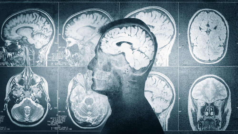 Human head on CT scan with brain background. Overlay on old paper texture. Retro style. Medical, science and education mri brain background. Magnetic resonance imaging. CT Gehirn