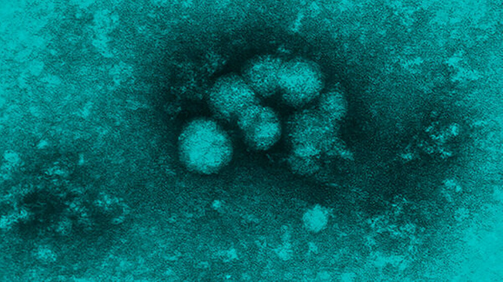 Hepatitis C (HCV): Das Hepatitis-C-Virus wird fast ausschließlich über Blutkontakte übertragen. Die Hauptinfektionswege verlaufen über die Mitbenutzung von Injektionsnadeln und über Bluttransfusionen, Blutgerinnungsfaktoren, nicht-sterile Tätowierna