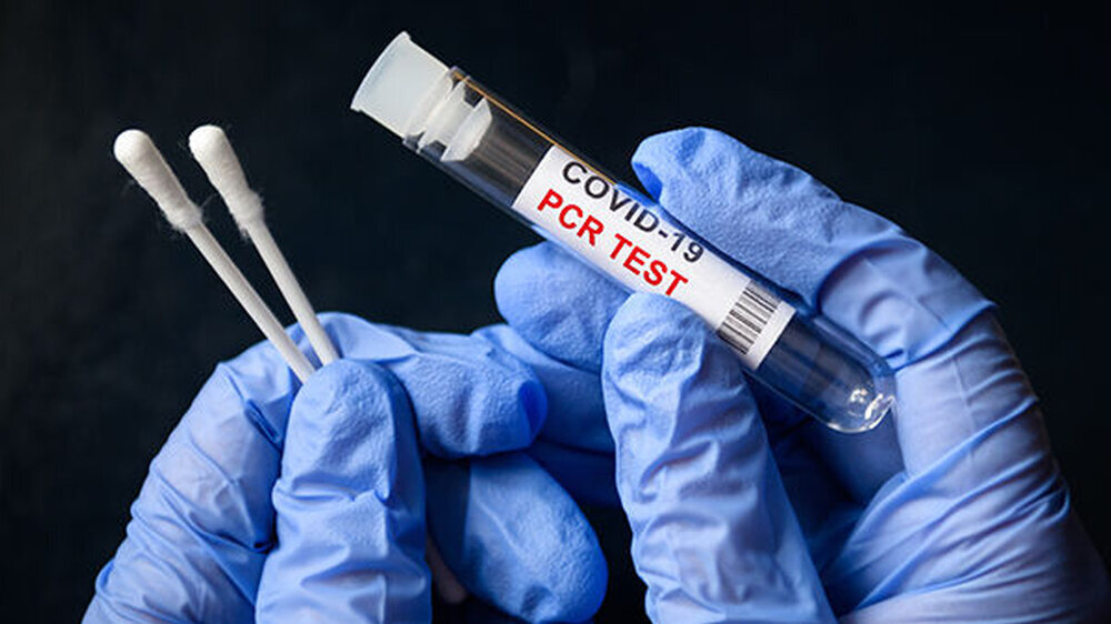 Kommt es zur geplanten Priorisierung von PCR-Tests, werden Proben von Beschäftigten aus Arzt- und Zahnarztpraxen wohl nicht vorrangig behandelt werden.