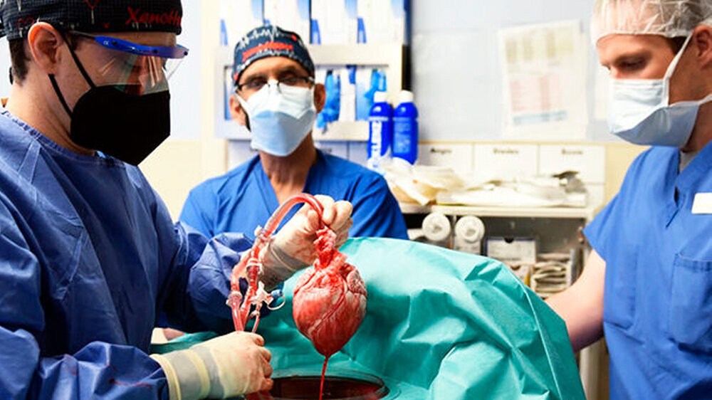 Chirurgen an der University of Maryland bereiteten im Januar 2022 das Schweineherz für die Transplantation vor.
