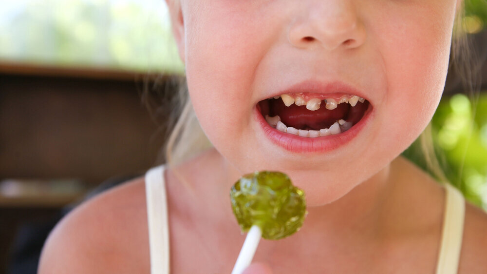Mädchen mit Lolli und Karies