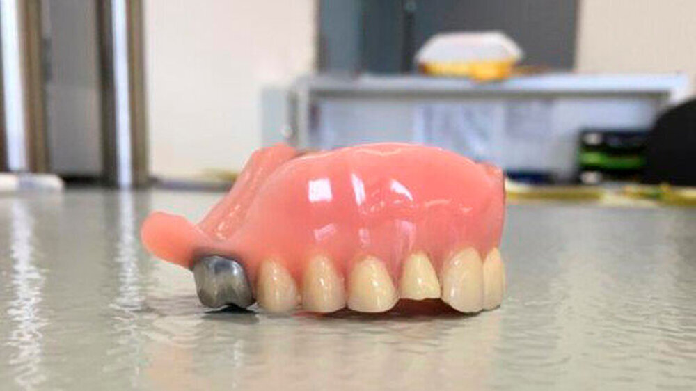 Kann man daraus noch etwas machen? Jein, sagte Zahntechnikermeisterin Maxi Findeiß aus Pößneck und zeigte Mögliches und Unmögliches anhand von Beispielen, die ihr Zahnärzte in das Dentallabor schicken. Mehr demnächst auf zm-online.de