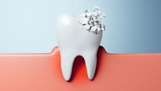 Prävention Mundgesundheit Schaden Zahnschmerzen