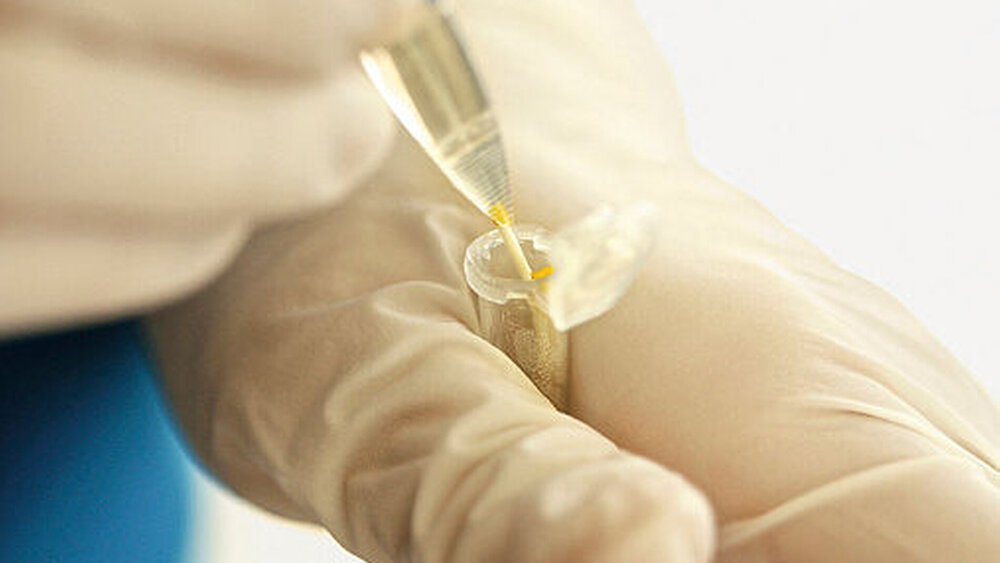 149294-flexible-1900 Abbildung 5: Um Verfälschungen bei der Verarbeitung der Proben zu verhindern, wird mit Einweginstrumenten gearbeitet: Einwegpinzetten und Einwegpipetten. |