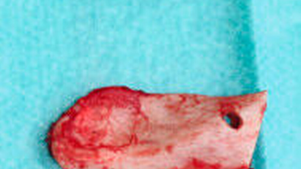 Abbildung 4: Operationspräparate zur histopathologischen Untersuchung |